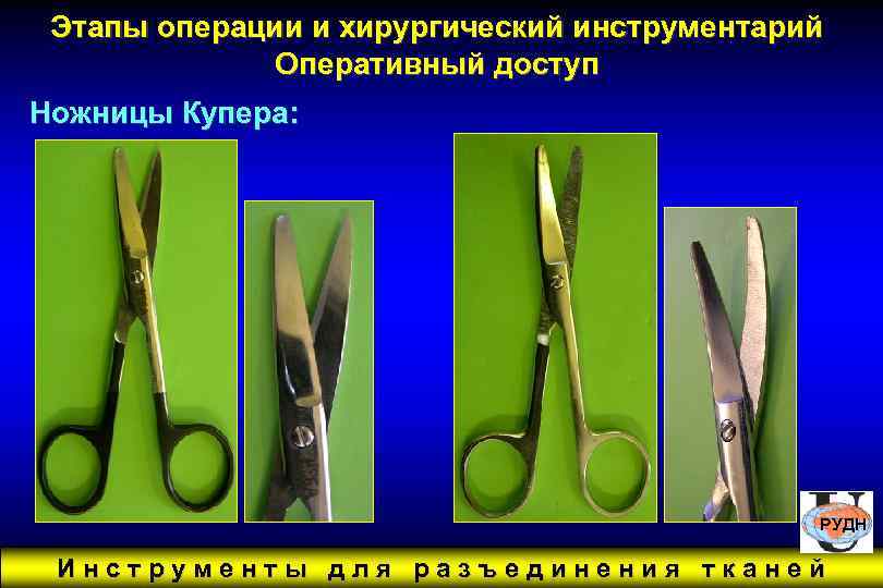 Этапы операции и хирургический инструментарий Оперативный доступ Ножницы Купера: РУДН Инструменты для разъединения тканей