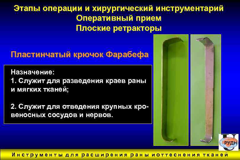 Этапы операции и хирургический инструментарий Оперативный прием Плоские ретракторы Пластинчатый крючок Фарабефа Назначение: 1.