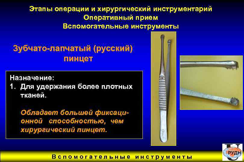 Этапы операции и хирургический инструментарий Оперативный прием Вспомогательные инструменты Зубчато-лапчатый (русский) пинцет Назначение: 1.