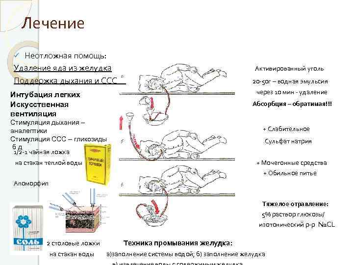 Лечение Неотложная помощь: Удаление яда из желудка Активированный уголь Поддержка дыхания и ССС 20
