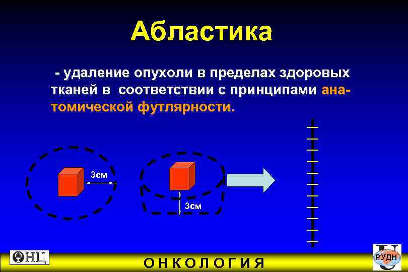 Абластика и антибластика в онкологии