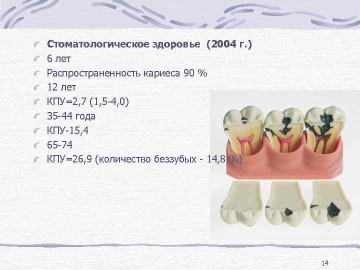 Стоматологическое здоровье (2004 г. ) 6 лет Распространенность кариеса 90 % 12 лет КПУ=2,