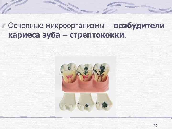 Основные микроорганизмы – возбудители кариеса зуба – стрептококки.    20 