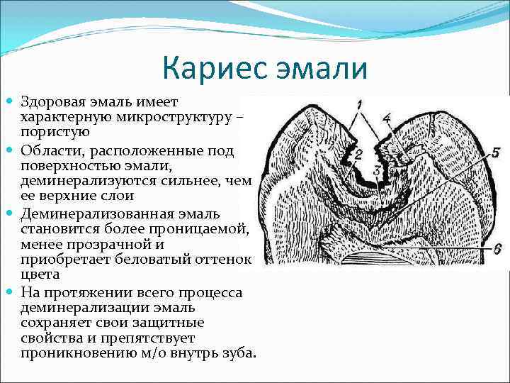     Кариес эмали  Здоровая эмаль имеет  характерную микроструктуру –