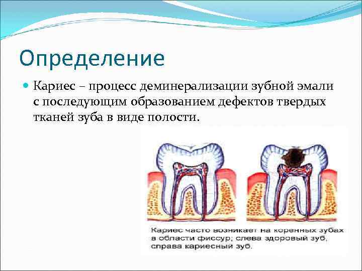 Виды полостей