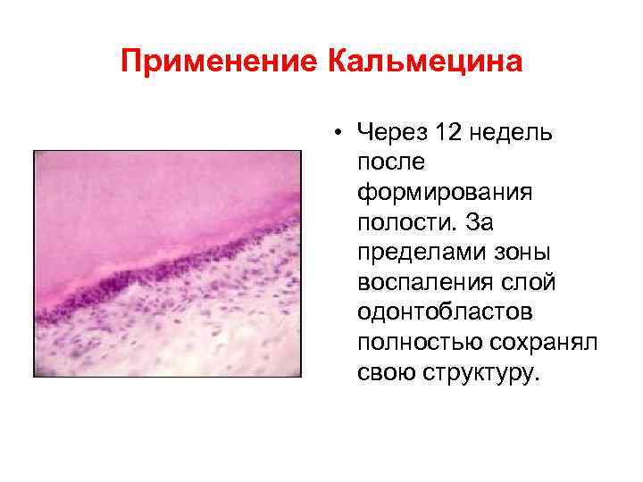 Применение Кальмецина   • Через 12 недель    после  