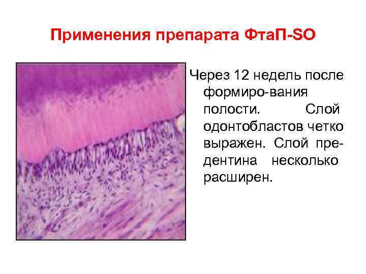 Применения препарата Фта. П-SO    Через 12 недель после   формиро-вания