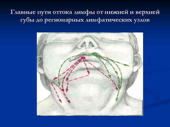 Главные пути оттока лимфы от нижней и верхней  губы до регионарных лимфатических узлов