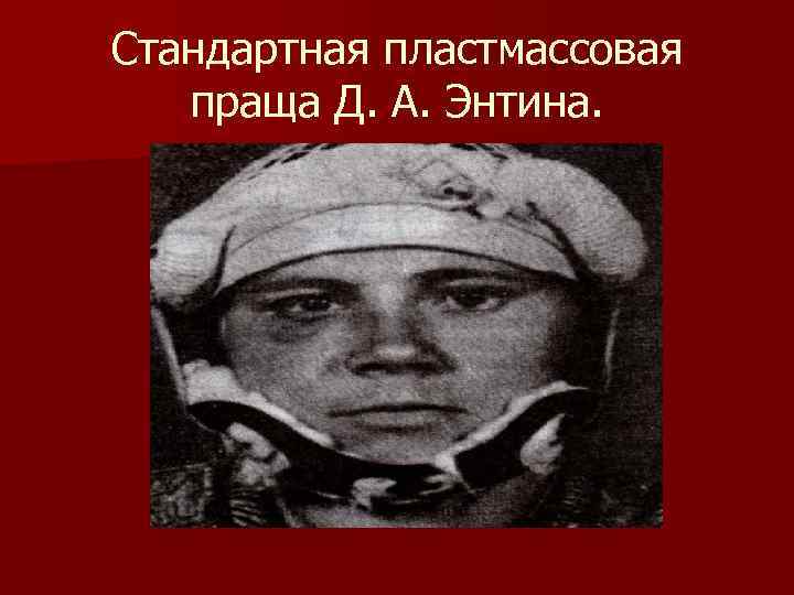 Стандартная пластмассовая праща Д. А. Энтина. Стандартная пластмассовая праща Д. А. Энтина.
