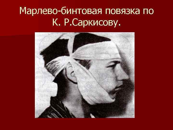 Марлево-бинтовая повязка по К. Р. Саркисову. Марлево-бинтовая повязка по К. Р. Саркисову.