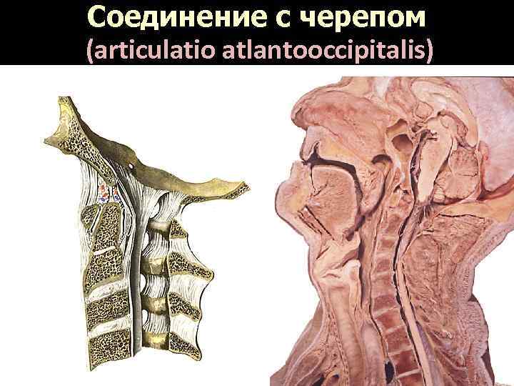 Соединение с черепом (articulatio atlantooccipitalis) 