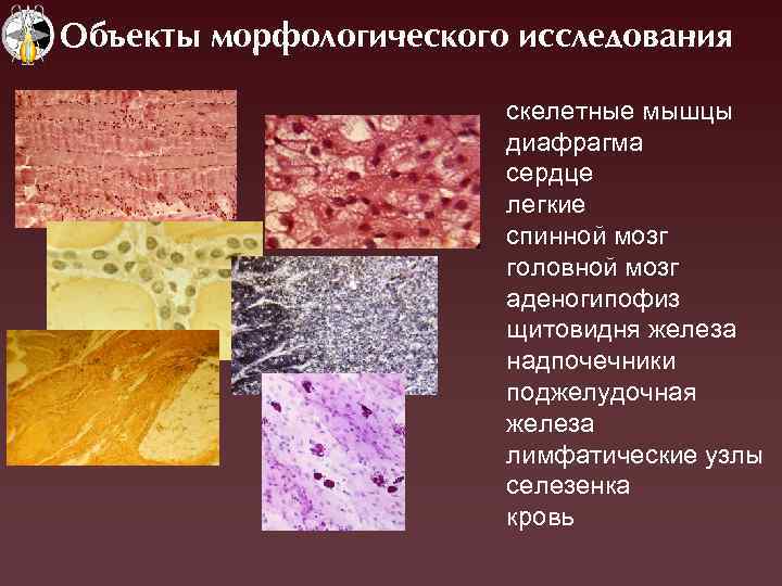 Объекты морфологического исследования скелетные мышцы диафрагма сердце легкие спинной мозг головной мозг аденогипофиз щитовидня