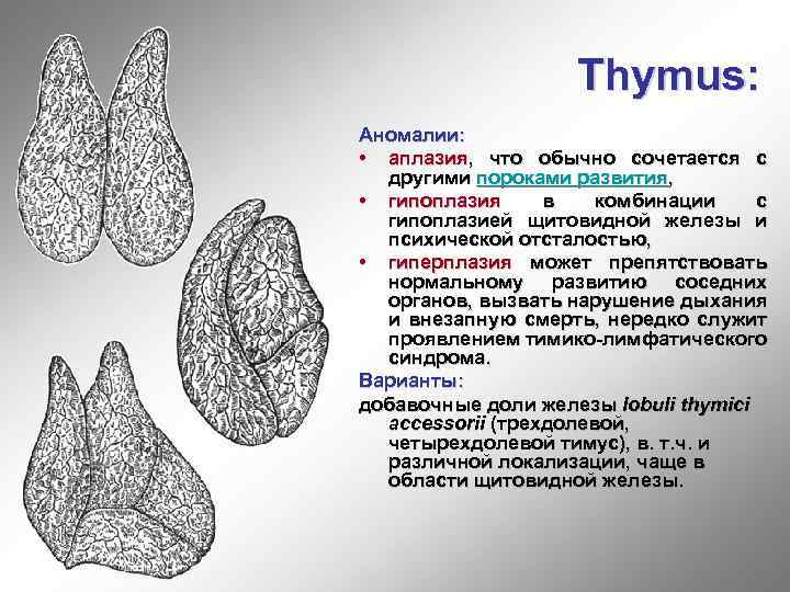 Thymus: Аномалии: • аплазия, что обычно сочетается с другими пороками развития, • гипоплазия в