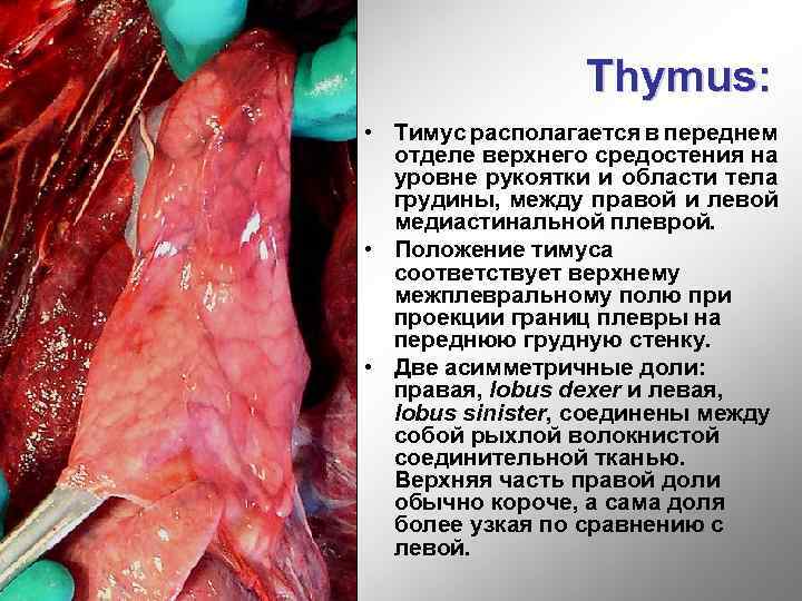 Thymus: • Тимус располагается в переднем отделе верхнего средостения на уровне рукоятки и области