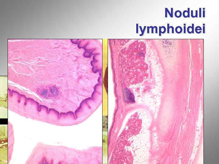 Noduli lymphoidei 