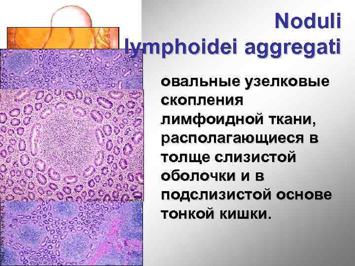 Noduli lymphoidei aggregati овальные узелковые скопления лимфоидной ткани, располагающиеся в толще слизистой оболочки и