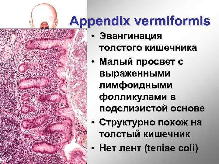 Appendix vermiformis • Эвангинация толстого кишечника • Малый просвет с выраженными лимфоидными фолликулами в