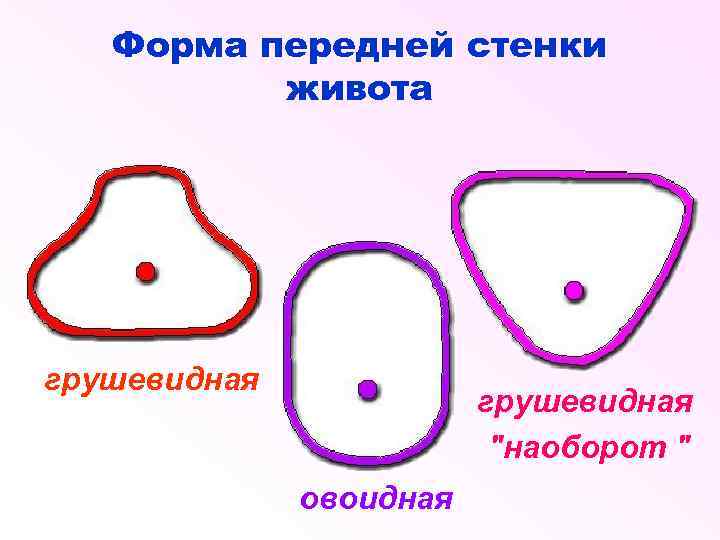 Форма передней стенки живота грушевидная 