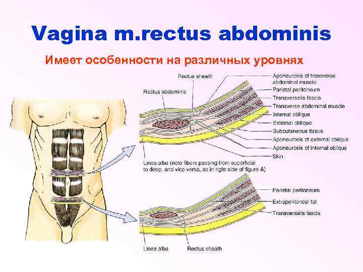 Vagina m. rectus abdominis Имеет особенности на различных уровнях 