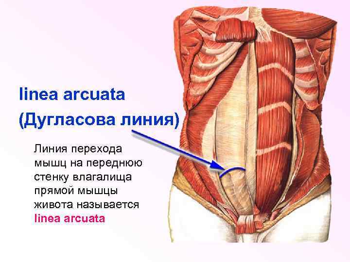 linea arcuata (Дугласова линия) Линия перехода мышц на переднюю стенку влагалища прямой мышцы живота