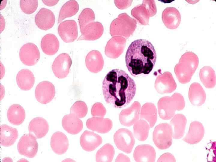 Нейтрофилы Являются микрофагами: мигрируют из крови в ткани и здесь фагоцитируют микробы и другие