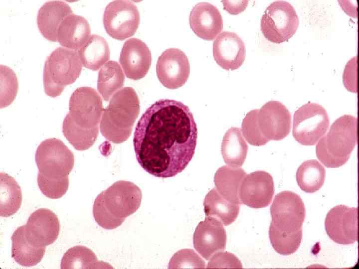 Моноциты l В тканях превращаются в макрофаги. l Последние а) осуществляют фагоцитоз (непосредственный или