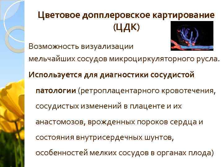 Цветовое допплеровское картирование (ЦДК) Возможность визуализации мельчайших сосудов микроциркуляторного русла. Используется для диагностики сосудистой