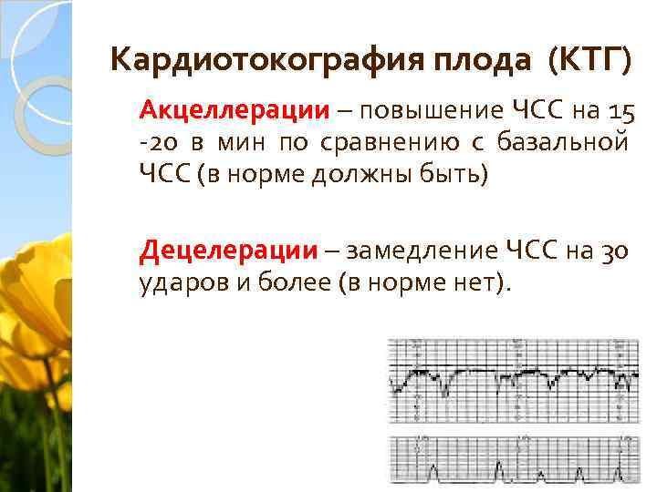 Кардиотокография плода (КТГ) Акцеллерации – повышение ЧСС на 15 -20 в мин по сравнению