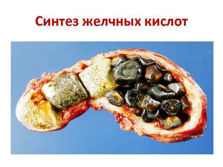 Синтез желчных кислот 