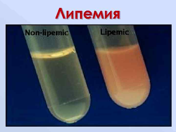 Определение степени липемии иктеричности и гемолиза образца