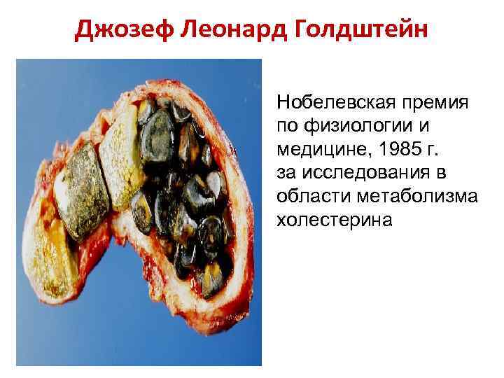 Джозеф Леонард Голдштейн    Нобелевская премия    по физиологии и