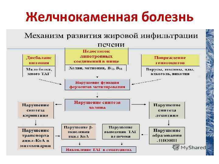 Желчнокаменная болезнь 
