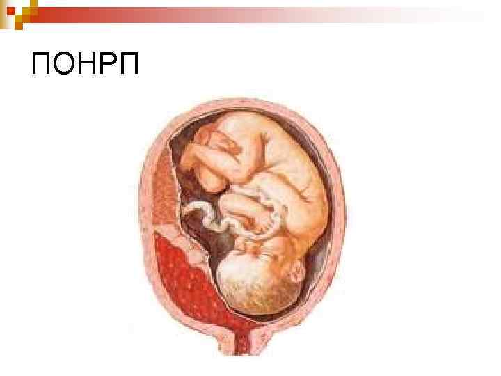 Плацента акушерство презентация