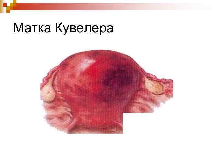 Матка Кувелера Матка Кувелера