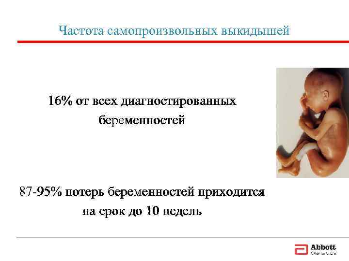   Частота самопроизвольных выкидышей   16% от всех диагностированных   беременностей