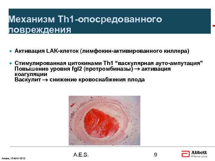   Механизм Th 1 -опосредованного повреждения  · Aктивация LAK-клеток (лимфокин-активированного киллера) 