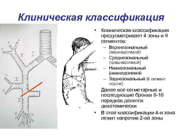 В прикорневых зонах усиление бронхососудистого рисунка