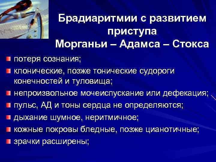 Брадиаритмии с развитием приступа Морганьи – Адамса Брадиаритмии с развитием приступа Морганьи – Адамса