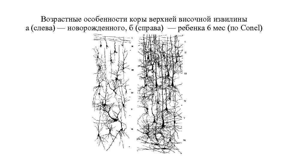 Возрастные особенности коры верхней височной извилины а (слева) — новорожденного, б (справа) — Возрастные особенности коры верхней височной извилины а (слева) — новорожденного, б (справа) —