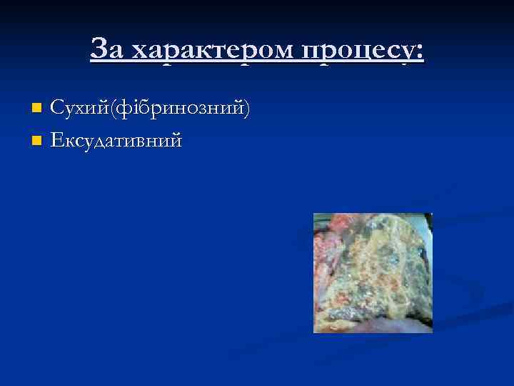  За характером процесу: n Сухий(фібринозний) n Ексудативний 