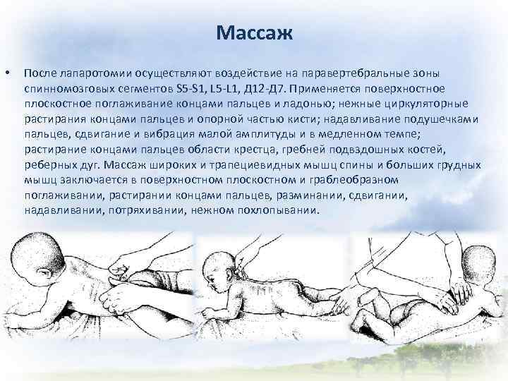 Массаж • После лапаротомии осуществляют воздействие на паравертебральные зоны спинномозговых сегментов S 5 -S