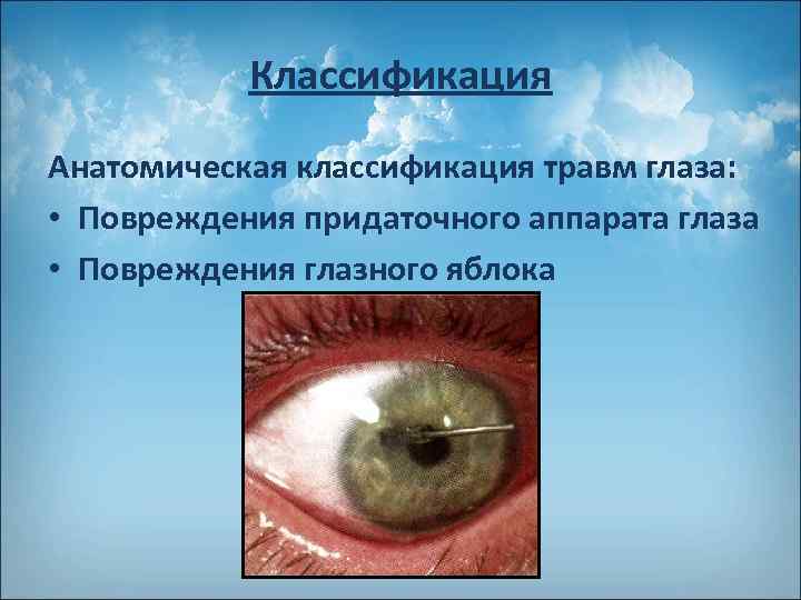 Классификация Анатомическая классификация травм глаза: • Повреждения придаточного аппарата глаза • Повреждения глазного яблока