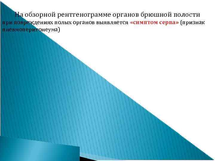   На обзорной рентгенограмме органов брюшной полости при повреждениях полых органов выявляется «симптом