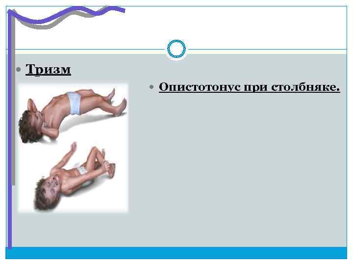 План обследования при столбняке