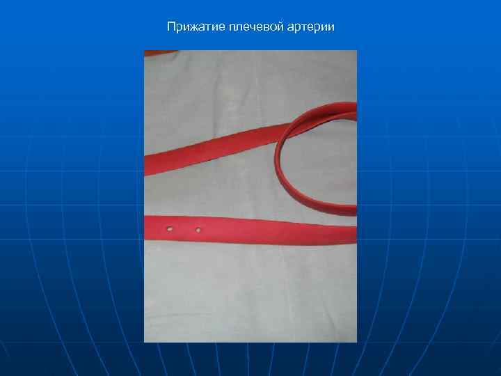 Прижатие плечевой артерии 