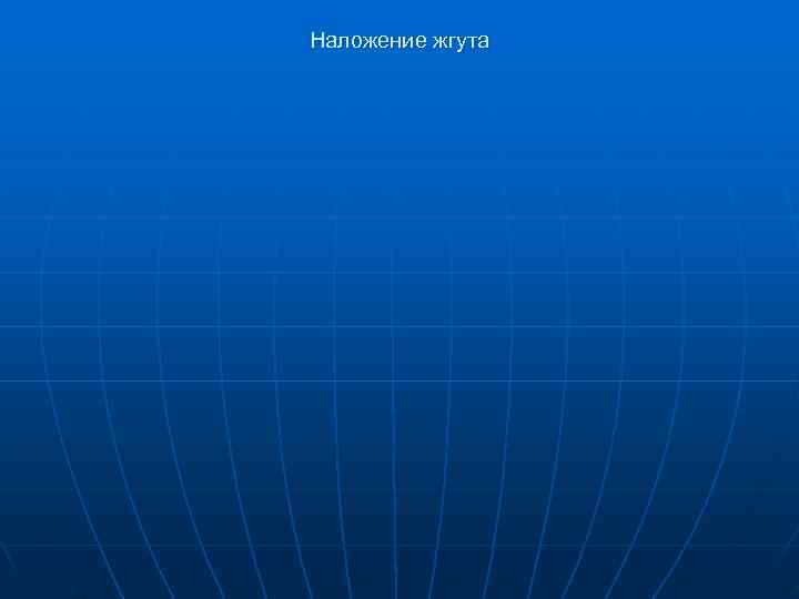 Наложение жгута 