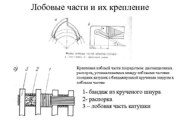 Лобовые части и их крепление    Крепление лобовой части посредством дистанционных 
