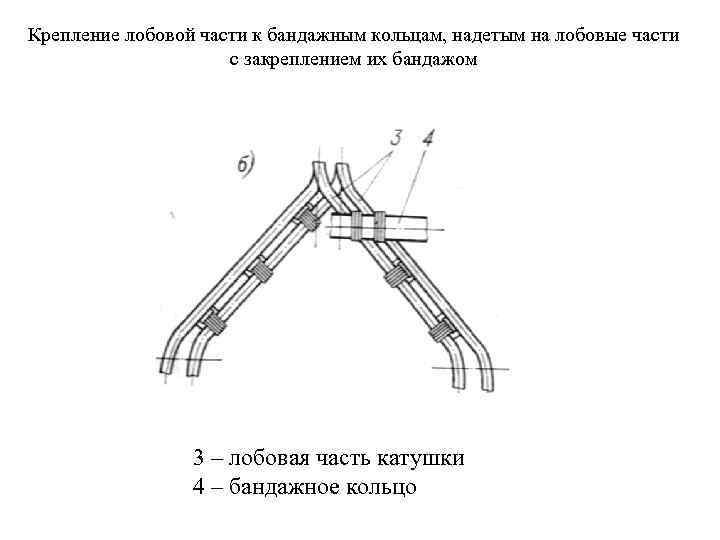 Крепление лобовой части к бандажным кольцам, надетым на лобовые части    