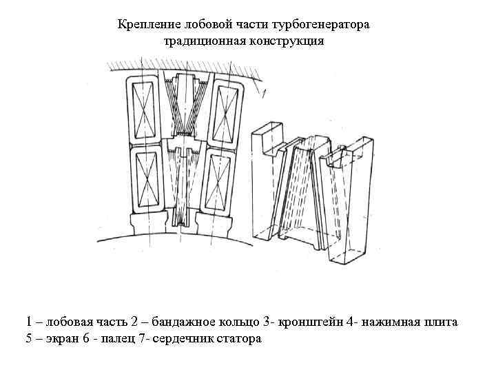    Крепление лобовой части турбогенератора     традиционная конструкция 1