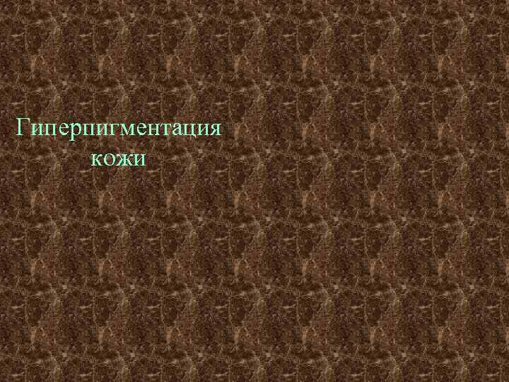 Гиперпигментация  кожи 
